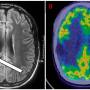 pet_scan.jpg