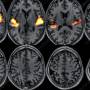 fmri_scan.jpg