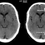 ct_brain.jpg
