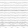 eeg.jpg