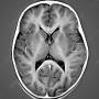 mri_brain.jpg