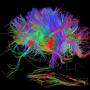 fmri_connectome.jpg